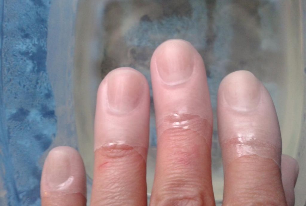 Парафинотерапия для ногтей